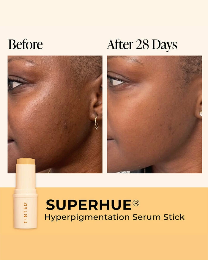 Live Tinted Superhue Treatments