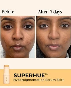 Live Tinted Superhue Treatments