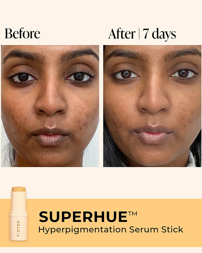 Live Tinted Superhue Treatments