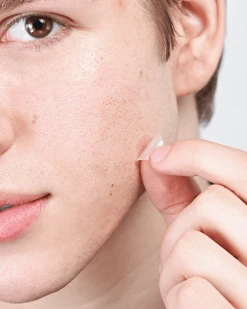 Hero Cosmetics Mighty Patch - Micropoint Acne