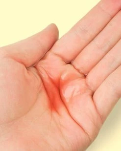 SOLVED SKINCARE Coconut Water Hibiscus + Rosehip Toner Acne