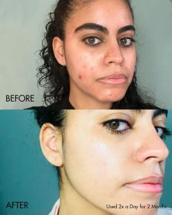 KLAIRS Freshly Juiced Vitamin C Drop Oily